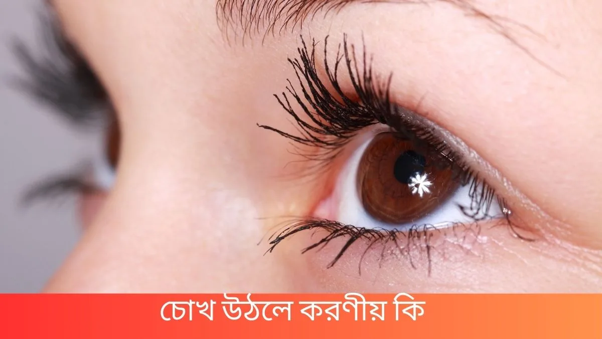 চোখ উঠলে করণীয় কি - চোখ ওঠার লক্ষণ ও প্রতিকার